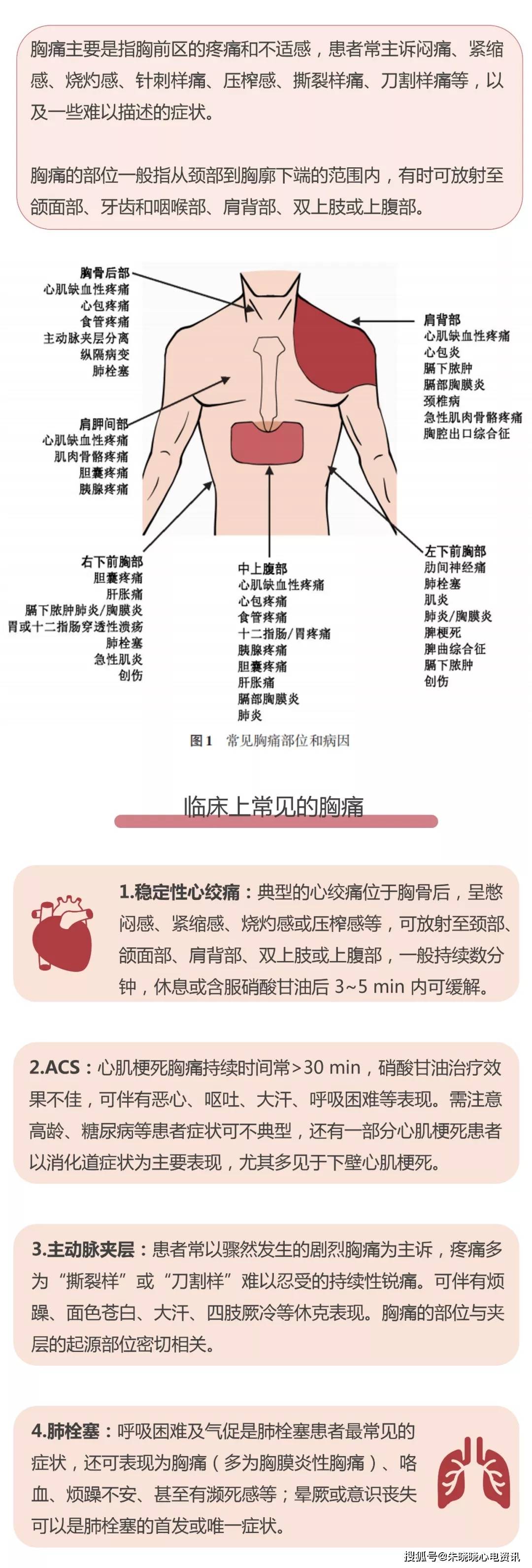 一图读懂胸痛的12种原因!