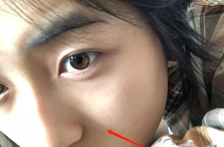 什么叫做双瞳 3c715eb4f2284775a83b961324e9b8c5.jpeg