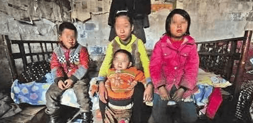 岁女孩需养三个弟妹欲轻生 女孩的两只手腕上 有数十道疤痕 弟弟