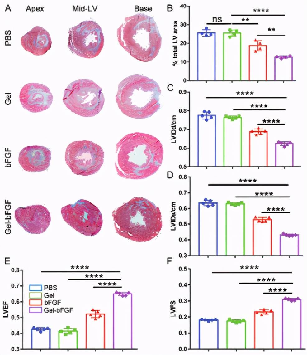 a)治疗后4周,代表masson的三色染色心肌切片.