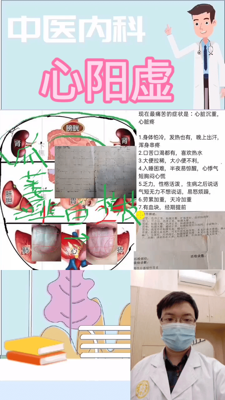 心阳虚心脏不适中医舌诊经方