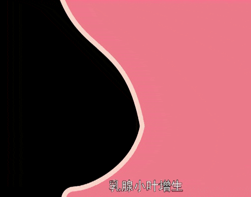 可以1秒看懂!_乳房