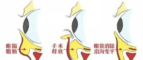 怎么算油腻 bf461fcfe8c544dcae6c1debddaf2526.jpeg