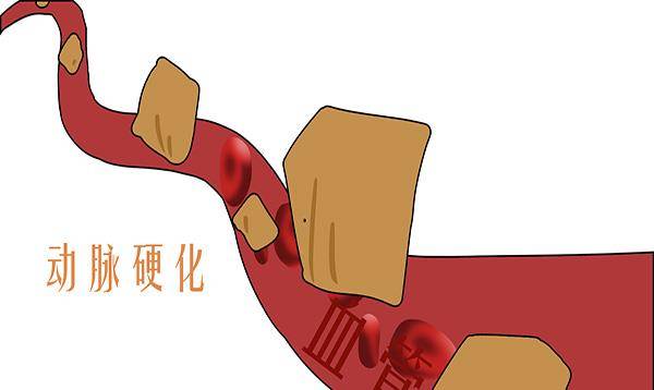 dd4137fd70a84b05a27060c4a92c61b7.jpeg
