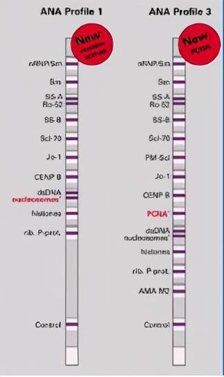 图2 国内普遍存在的自身抗体盲目和固定组合检测产品很显然,自身抗体