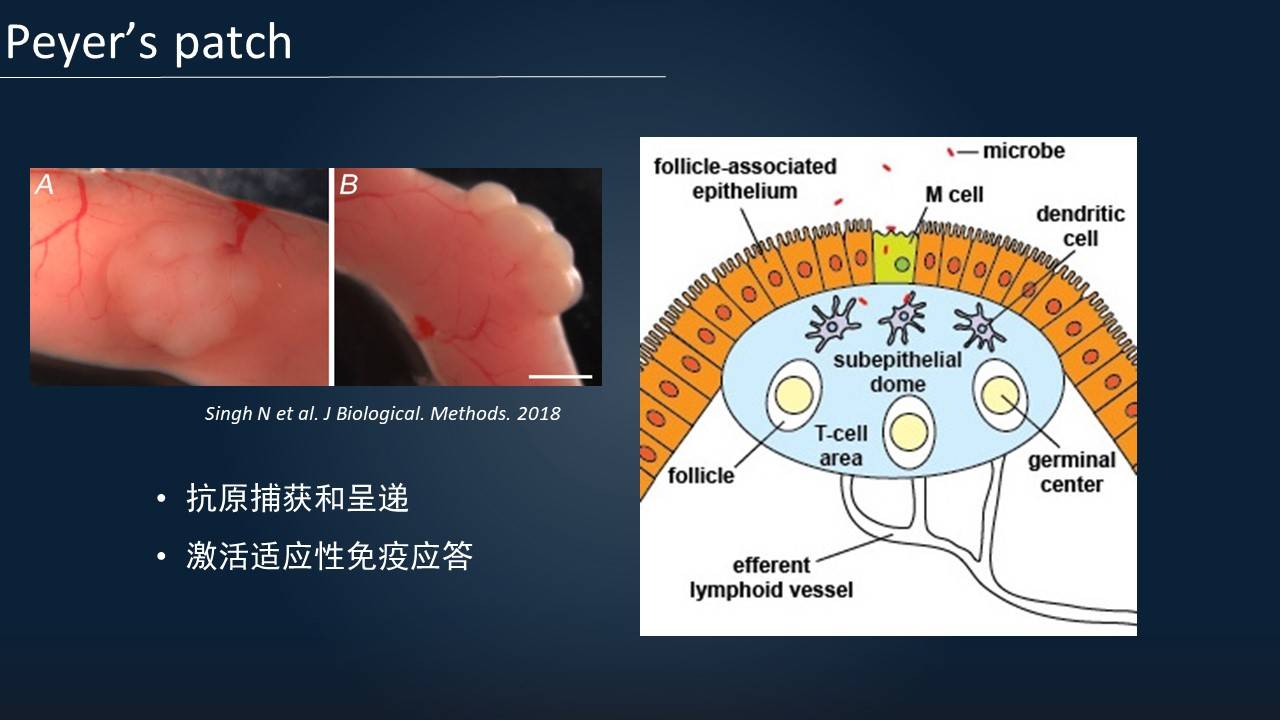 原創王碩17分鐘一覽腸道黏膜免疫研究進展