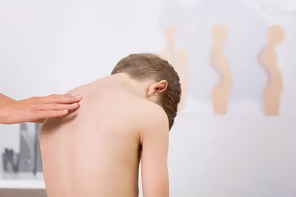 先天性脊柱裂已经40年了 13岁儿童骶椎隐裂尿床治疗