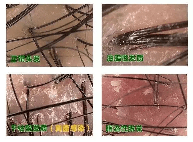 可以针对性的检查头皮的健康状态,诊断脱发类型,脱发等级,头皮环境