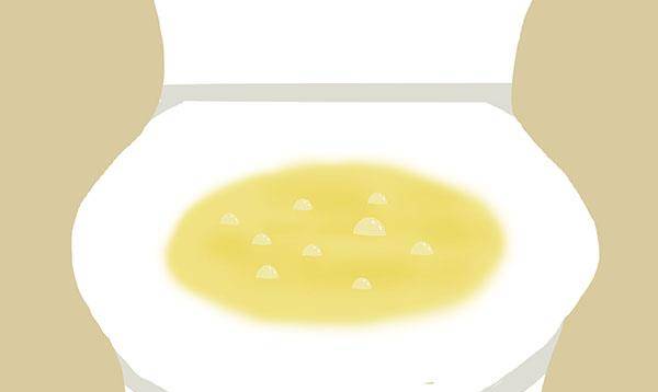 吃什么药会导致小便泡沫 51b00b09ffa14a3c90e9957148fc9431.jpeg