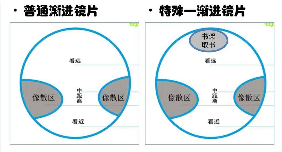 中年近视 老花,爱尔渐进镜一副帅气解决远中近清晰问题_检查数据