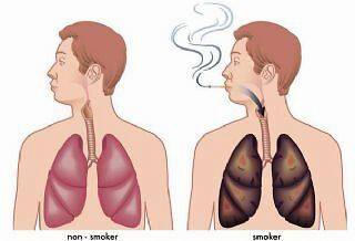 急性上呼吸道感染咳嗽多久能好 835330ffe221438e88064fdc3c6340a1.jpeg