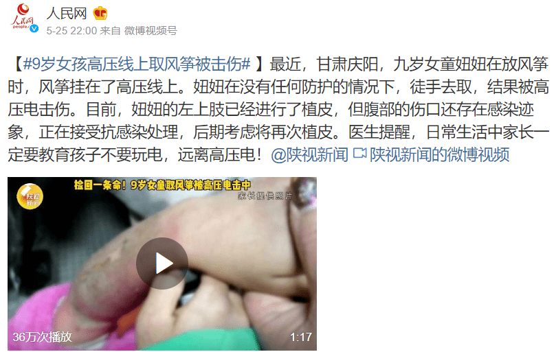 9岁女孩高压线上取风筝被击伤,这些居家用电安全,务必教会孩子