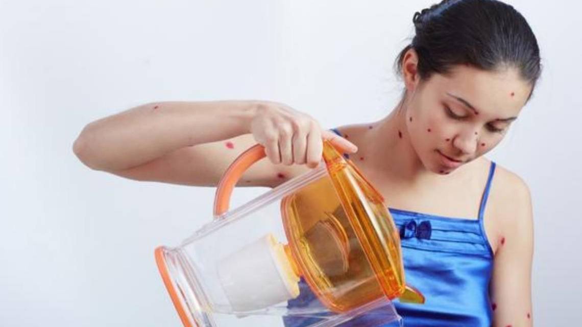 喝什么降尿酸最快 4d697d20e1cd47768f5b02b12374cfe3.jpeg