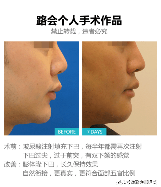 怎么才可以让自己变得美 c86d07f9bc064a508143826165572a01.png