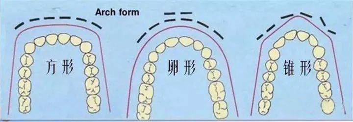 咬合|笑起来满嘴都是牙？你不知道的“微笑颊廊”是get元气感笑容的关键