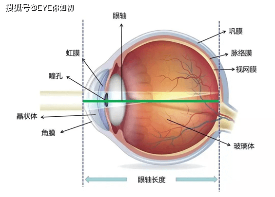 什么是单纯性近视 28b741905edc4c719f78765112c9bcfc.png