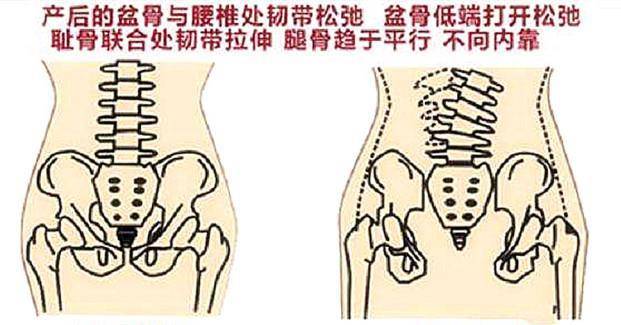 赵丽颖家的"骨盆正骨器"曝光,坦言产后不易,生过娃的妈妈感同身受
