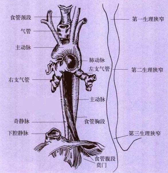 異物最常嵌頓於食管入口(第一生理狹窄),其次為食管中