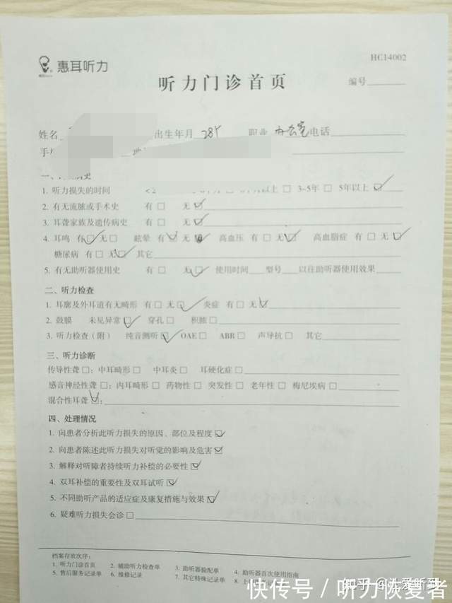 年轻人单耳失聪需要戴助听器吗 巴南助听器 听力
