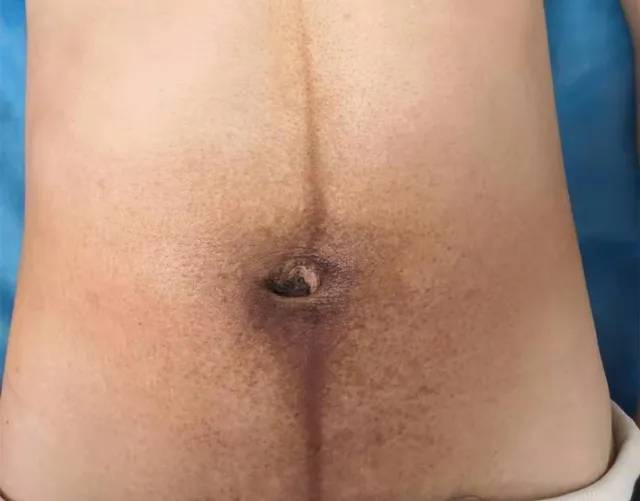 治疗|妈妈党必看|调整体态秒变美，不做“小乌龟”