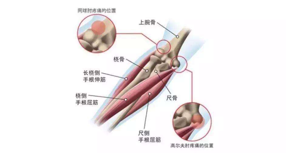 成语什么桡尺_桡尺关节在什么位置(3)