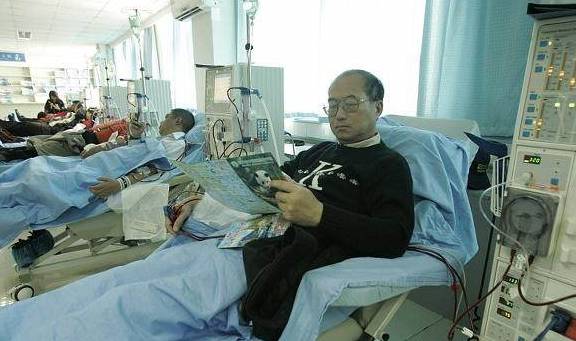 肾脏|尿毒症早期显著的3个“现象”你都知道哪几个,快来看看吧!