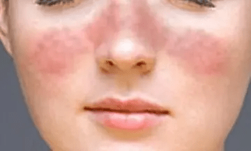 53168650995640a0b6809a12a1c88537.png