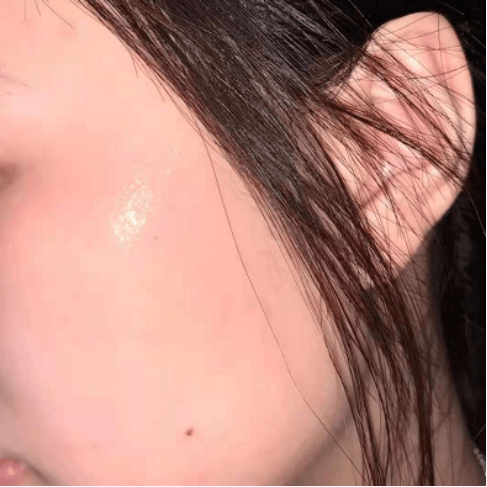 黑头|建议女生护肤远离这四个“坏习惯”，不然皮肤变差，黑头痘痘变多