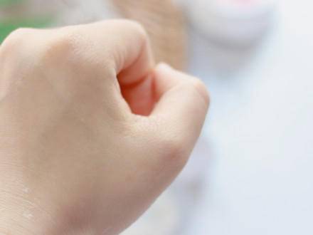 晒斑|这点没做好，脸上的斑肯定找上门