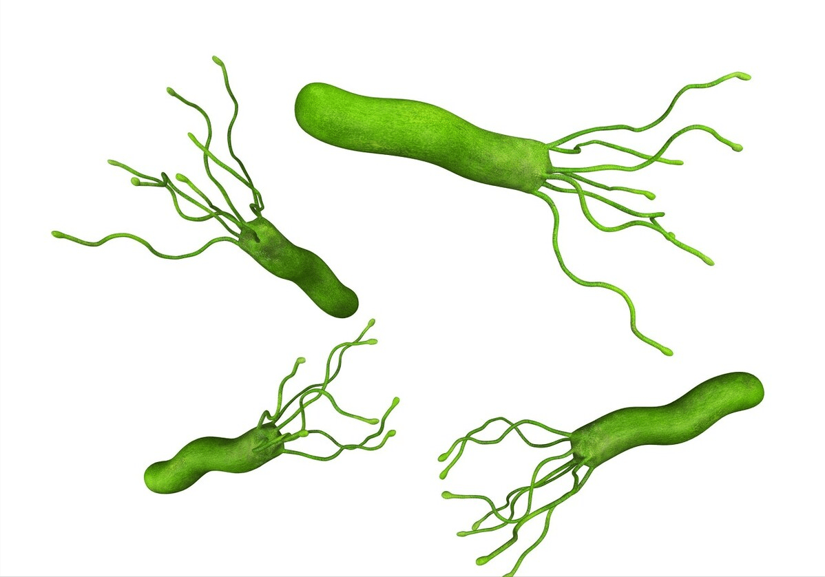 幽门|为何我国胃癌生存率仅23%，而日本高达80%？这2个原因值得思考