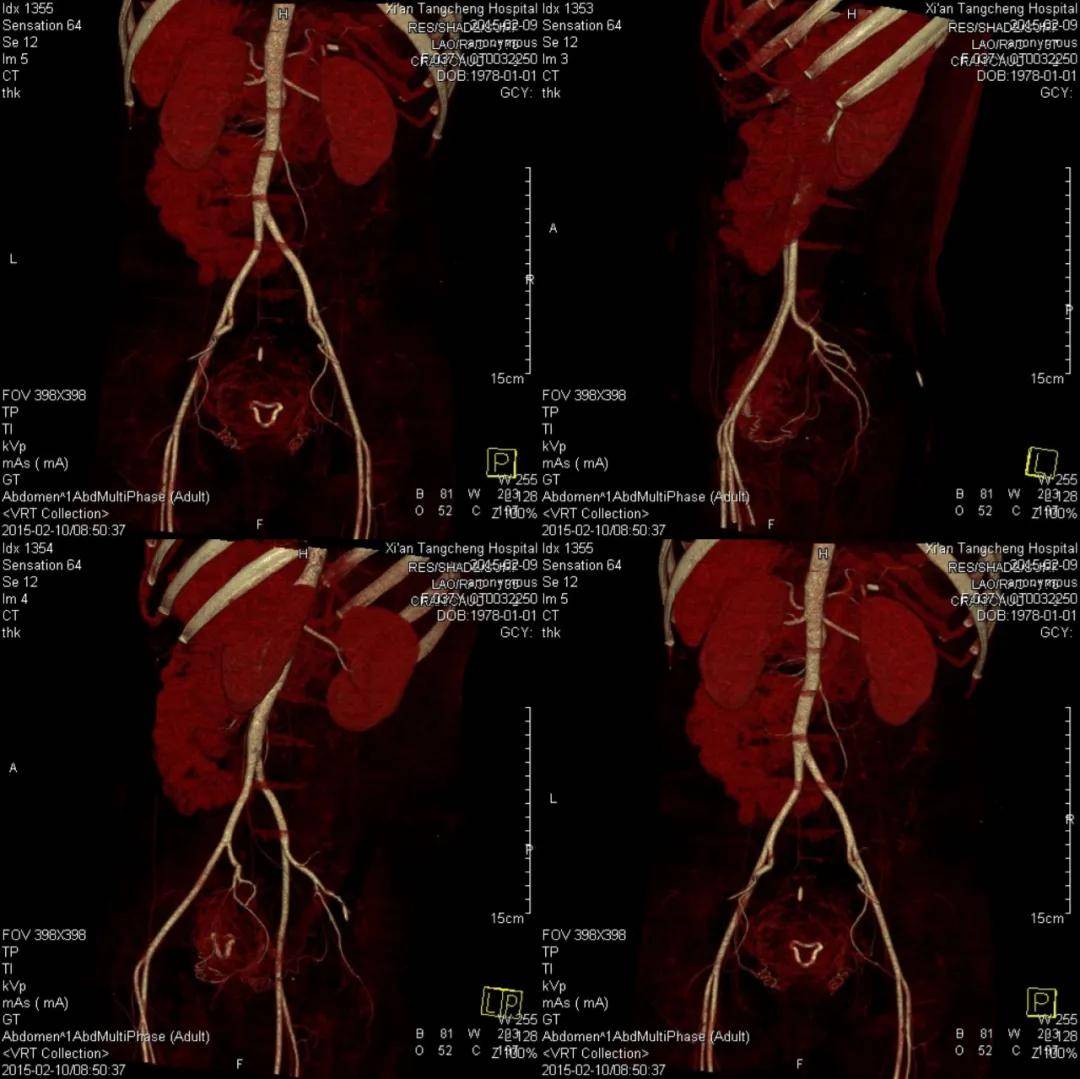 成像|【科室推荐】西安工会医院影像科