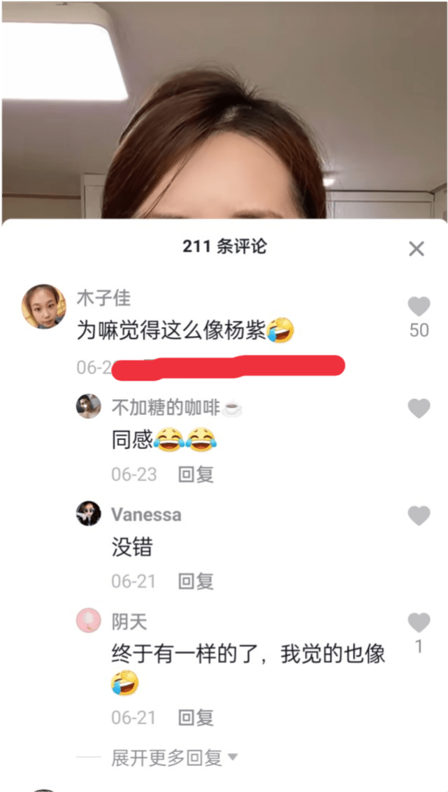 米卡|男网红多次整容后变伪娘，撞脸杨紫，坦言脸上有很多钛合钉，过安检都会响