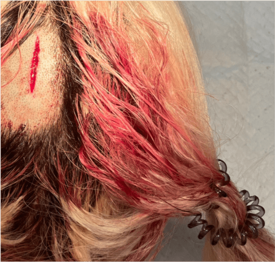 原创男网红控诉男友家暴被扇耳光用衣架击打头部晒聊天记录和伤情照