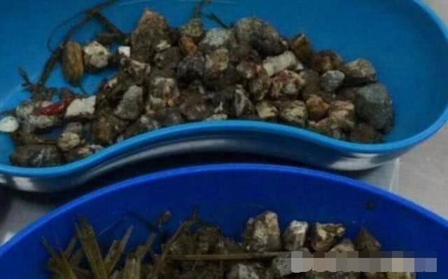 男子見流浪狗昏倒路邊, 帶去醫院檢查後, 肚子裡竟取出這東西! 萌趣萌寵 第3张