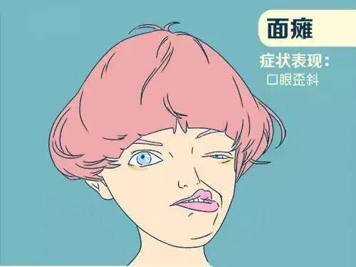 功能|面肌痉挛就是面瘫？两种疾病傻傻分不清 专家：病因不同，别乱治！