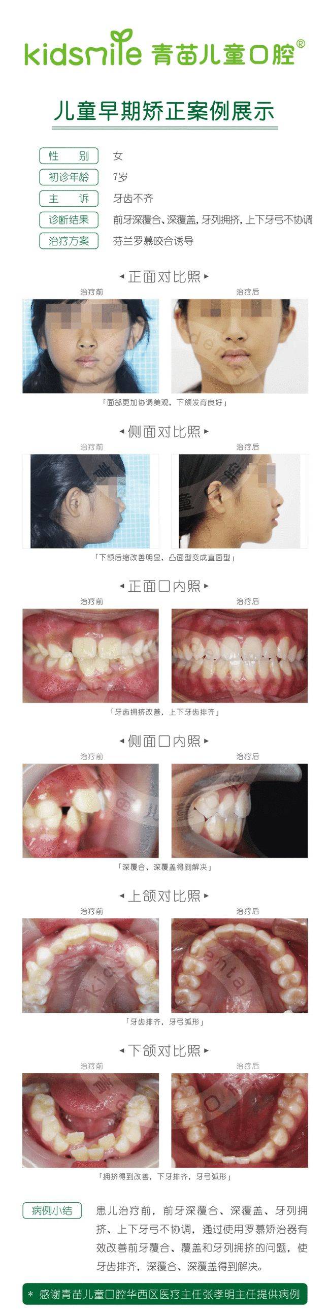试问“脸大君”能有几多愁？恰似一江春水向东流~来测试一下你是什么脸？