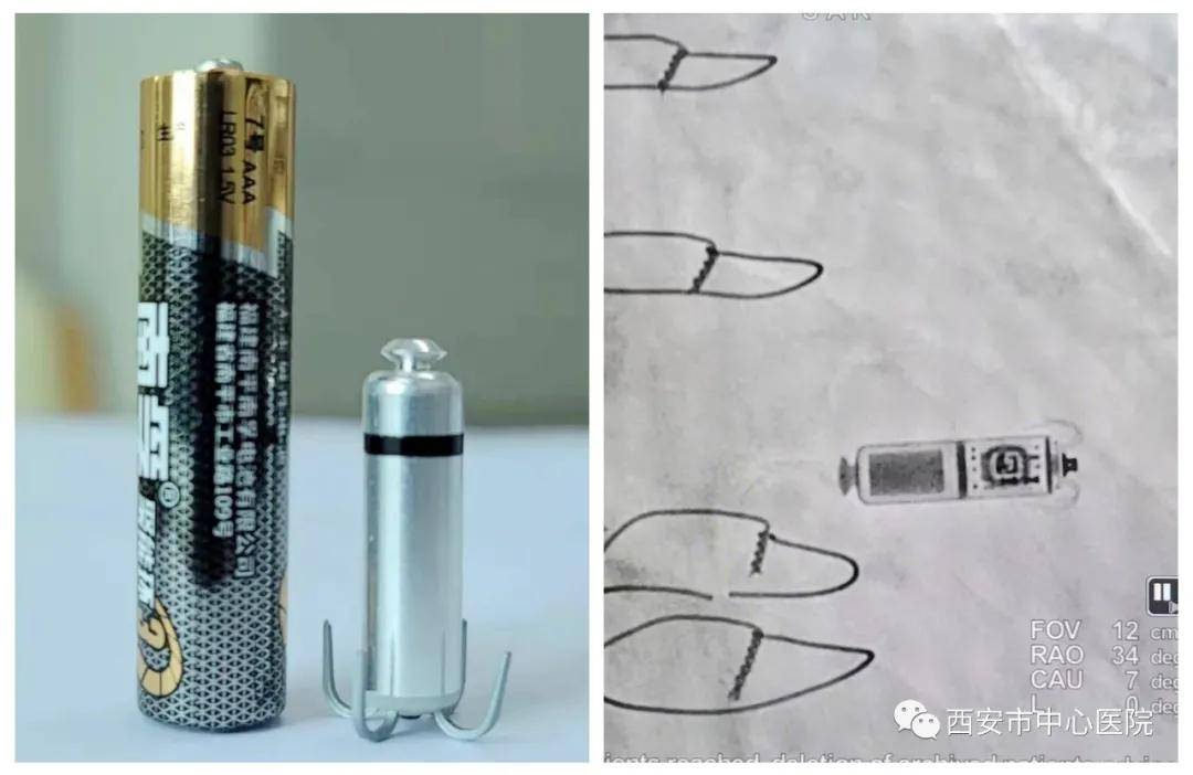 生理|西安市中心医院心内科与心电图室进行学术交流　共筑患者安全长城