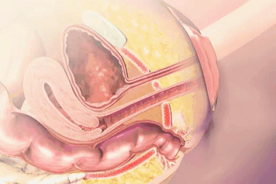 琳达|大连美琳达妇产医院：女性产后盆底肌修复有多重要 也许你还不清楚