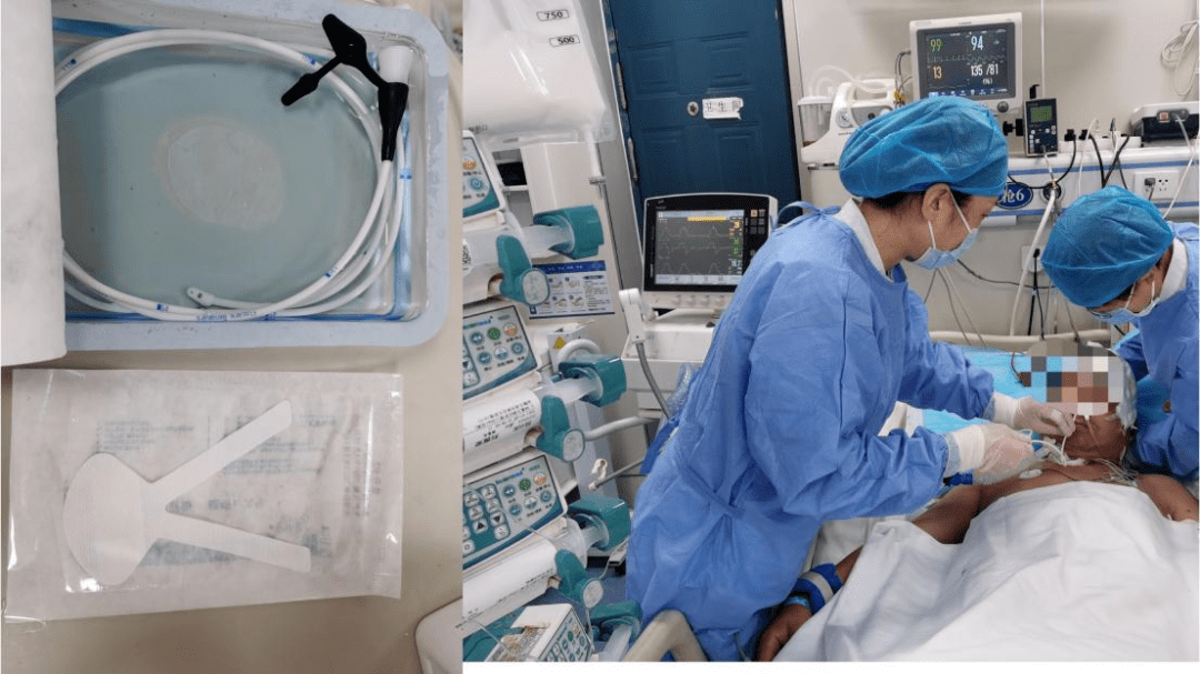 团队|加强营养 促进康复 ——记神经外科护理团队成功开展床旁盲探鼻空肠管置入术