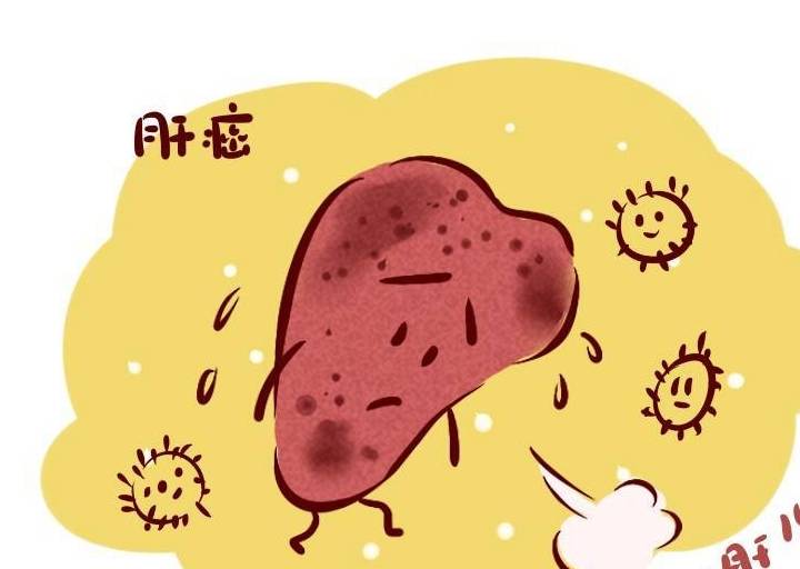 肝脏|肝病不能早期发现?身体出现“2红1黄”,警惕疾病中晚期