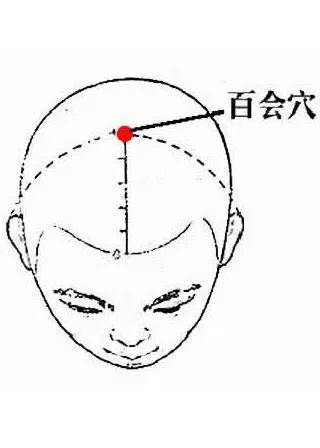 埋线疗法对什么病疗效最好 fefcf384c0c443d9ba7f0ef691f1e17c.jpeg