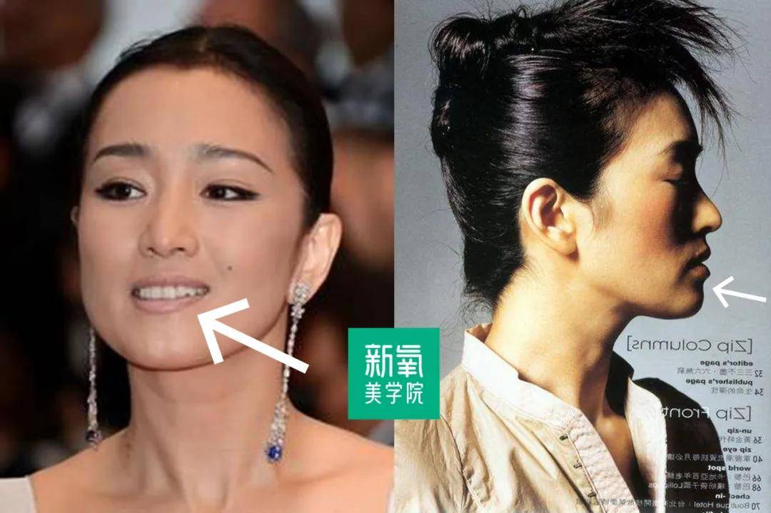 下巴|关晓彤的嘟囔下巴照这个古典路子走能封神？