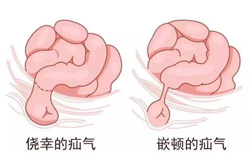 且在同樣的位置形成孔道,但這孔道與睪丸的包膜相連,所以陰囊內也會