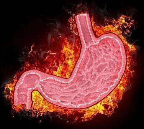 食品|胃不痛但老是烧心，这是什么原因呢？