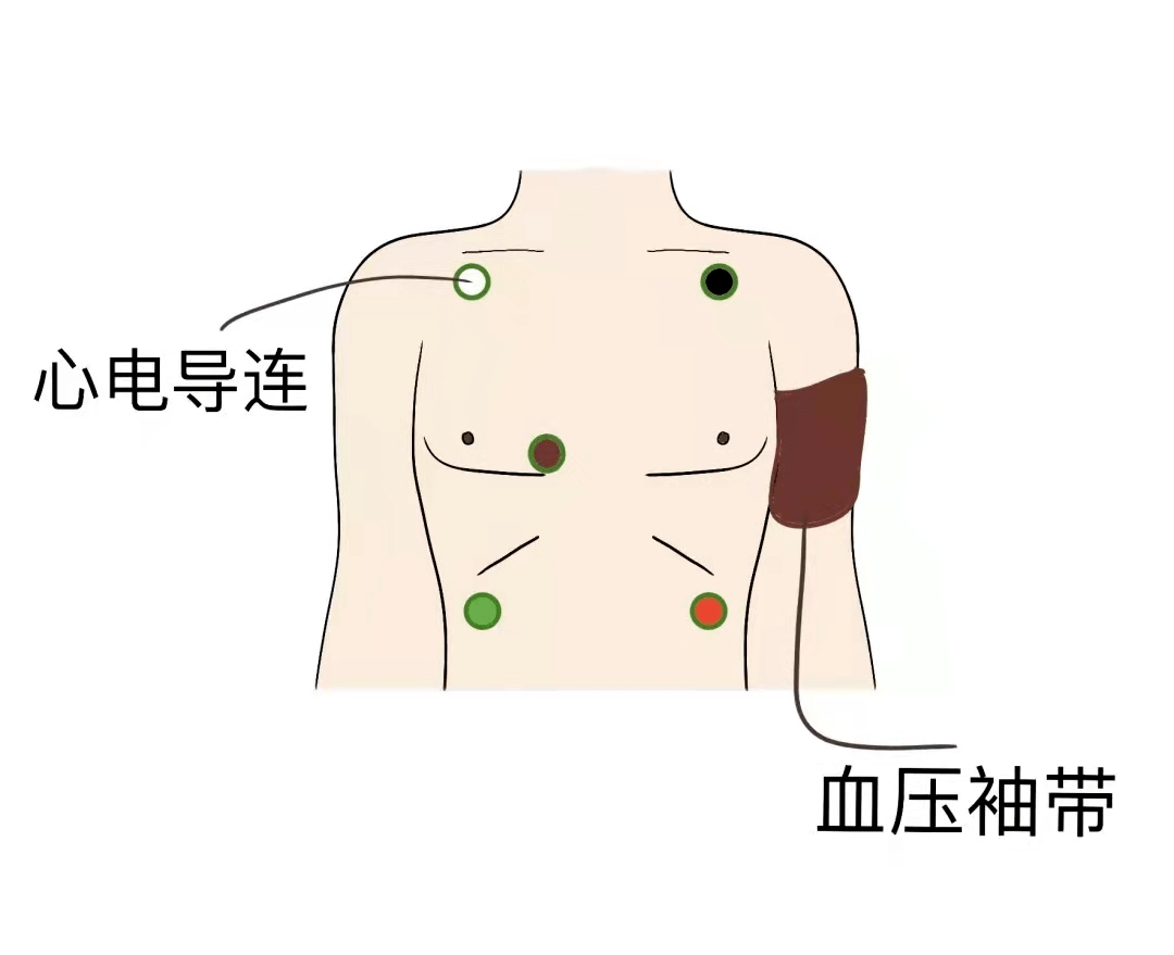 监测|麻醉不就是打一针就好了么？专家：才没那么简单