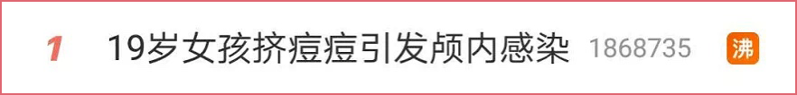 黑头|痘痘肌该怎么护理？这波科普要收藏！