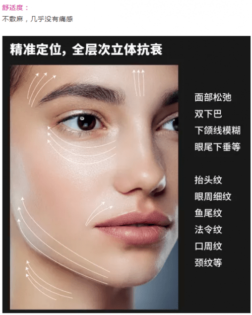 作用|最全光电抗衰项目大盘点，看看哪款是你不知道的~