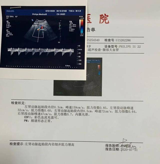 肾脏|直到肾衰了才被发现，这种肾病其实很常见