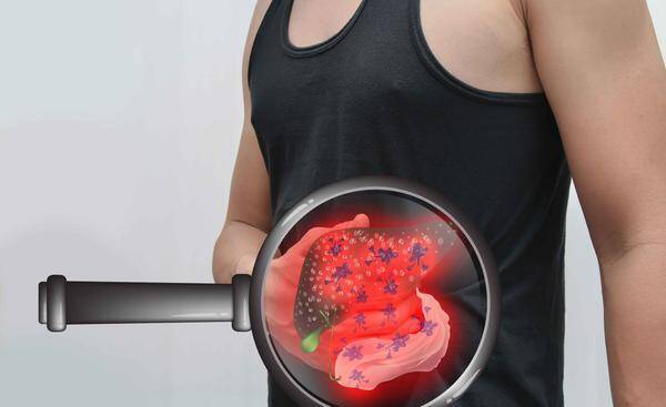 症状|肝部有囊肿，或与这5个因素有关，要小心预防