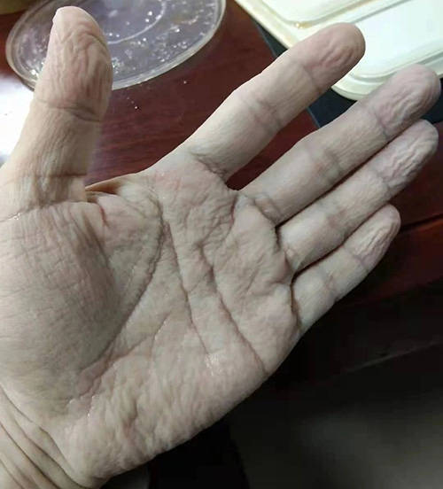 一线|冲锋一线，再战“疫”情，郑州仁济在行动